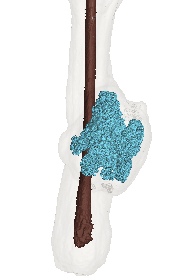 Analyse et visualisation de volumes des glandes sébacées