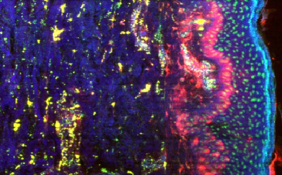 Cartographie des éléments chimiques réalisée sur une coupe histologique de peau: le phospore est bien visible dans le noyau des cellules, le fer dans les zones vascularisées (prolifération), et le potassium assez largement distribué.